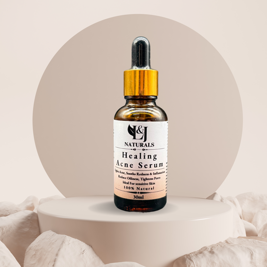 Natural Oil Control Acne Serum - L&J Naturals